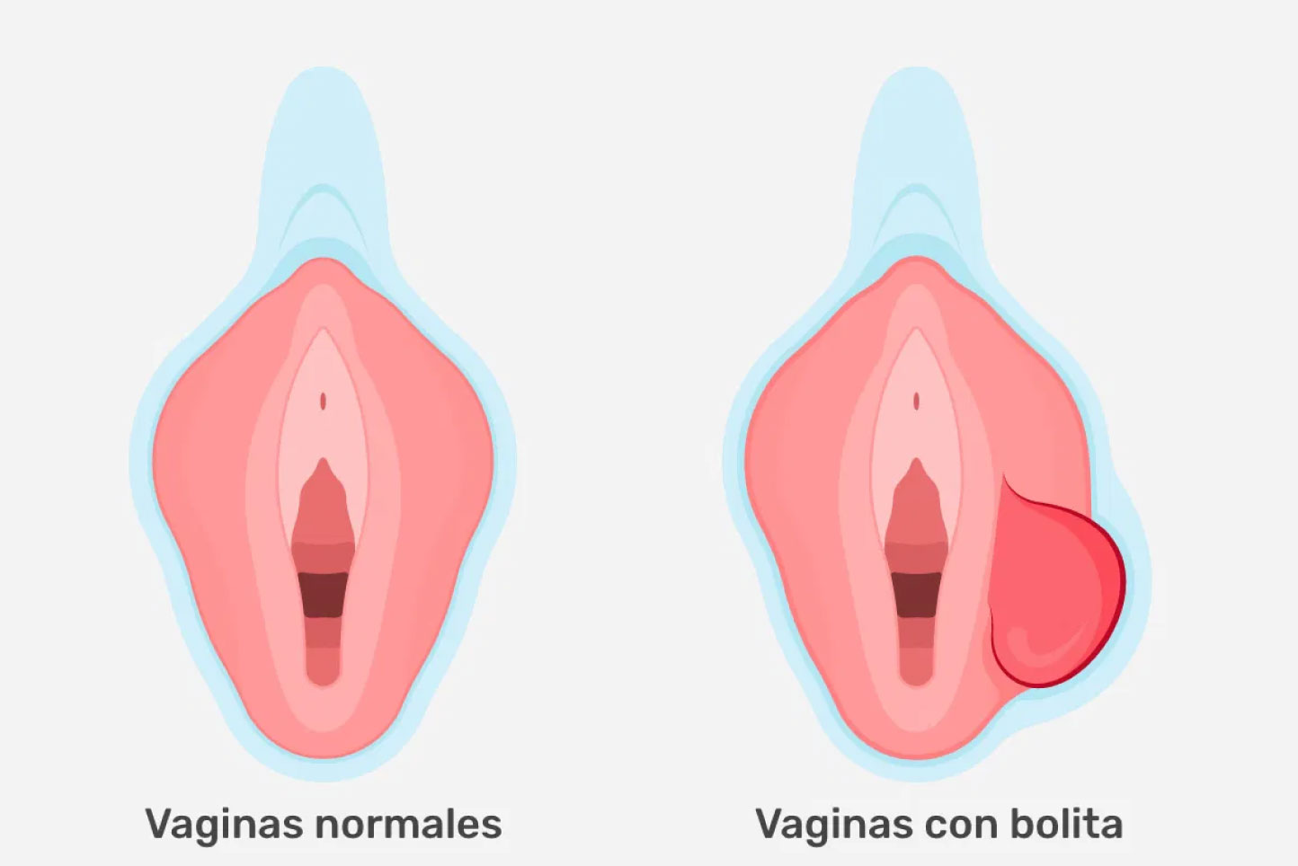 Todo sobre la glándula de Bartolino: ¿qué pasa si aparece una bolita en tu zona íntima?