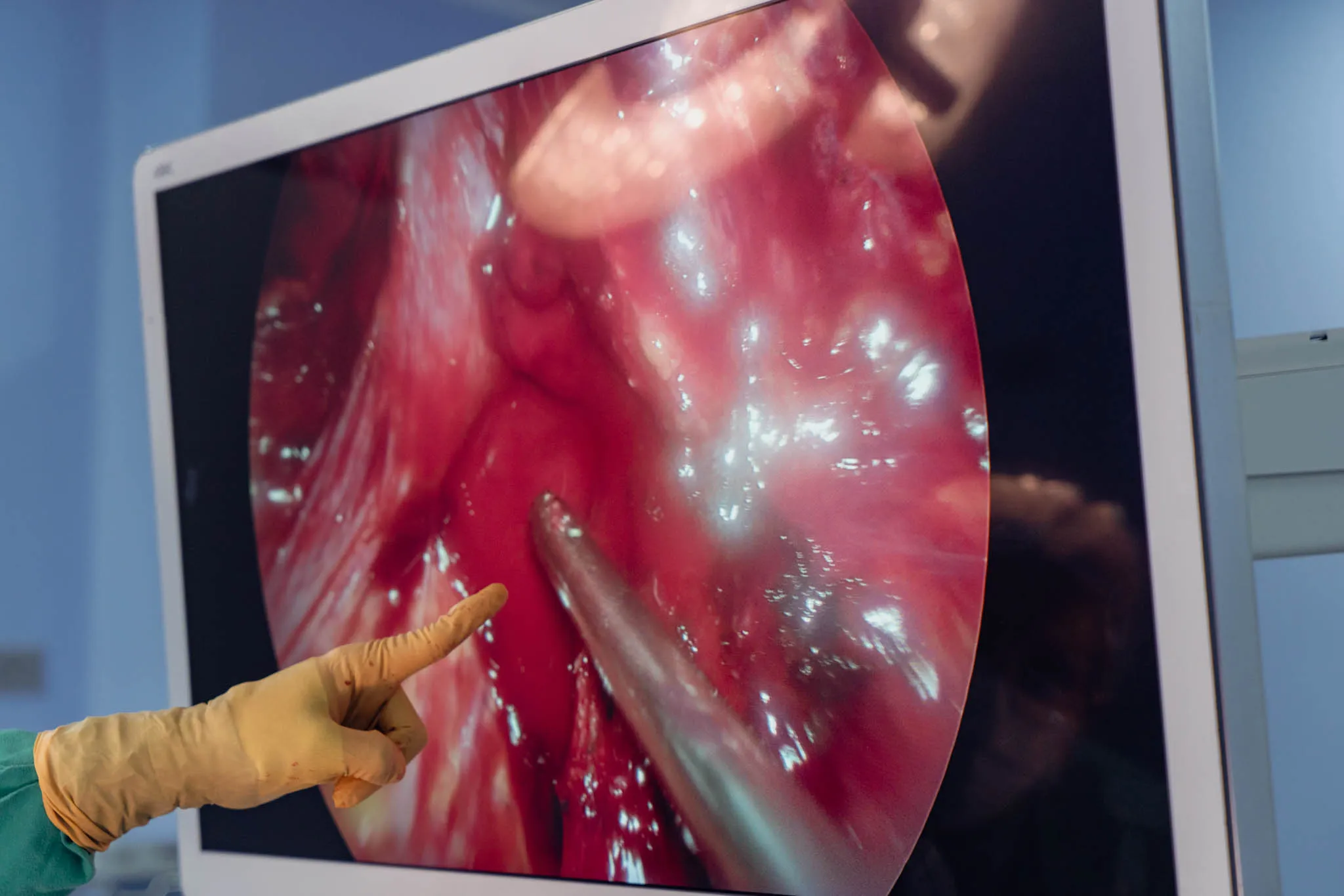 Cirugía laparoscópica y técnicas mínimamente invasivas